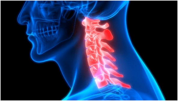 dor no pescoço leva a dores nas costas