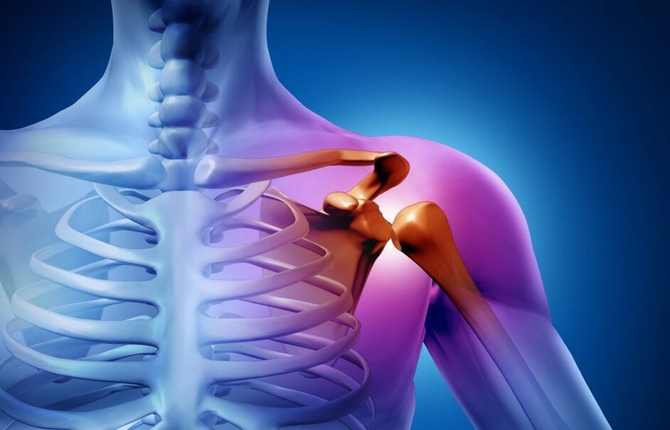 lesão da articulação do ombro devido a artrose