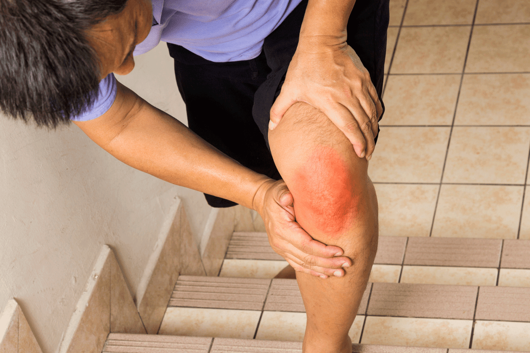 dor nas articulações devido à artrose